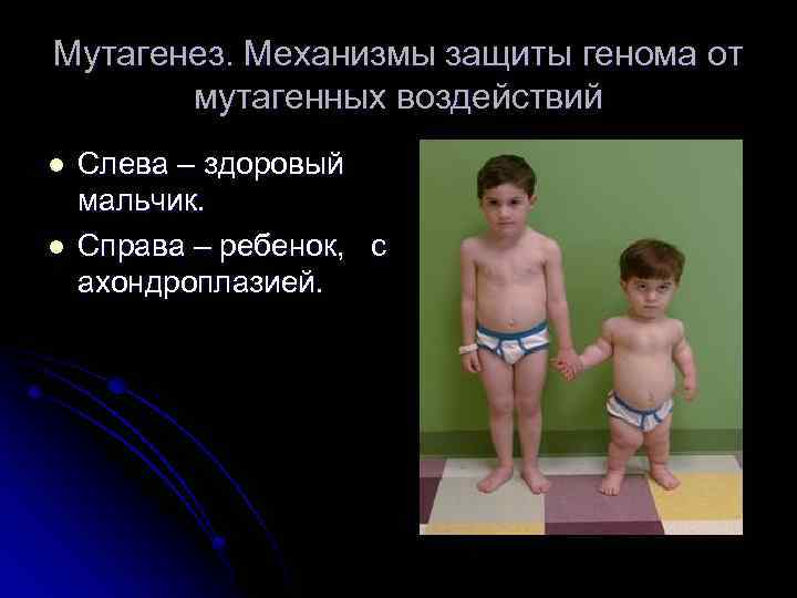 Мутагенез. Механизмы защиты генома от мутагенных воздействий l l Слева – здоровый мальчик. Справа