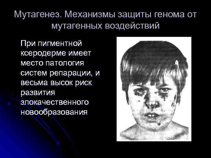 Мутагенез. Механизмы защиты генома от мутагенных воздействий При пигментной ксеродерме имеет место патология систем