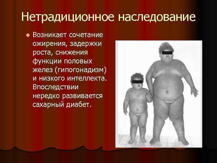 Нетрадиционное наследование l Возникает сочетание ожирения, задержки роста, снижения функции половых желез (гипогонадизм) и