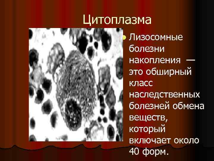 Цитоплазма l Лизосомные болезни накопления — это обширный класс наследственных болезней обмена веществ, который