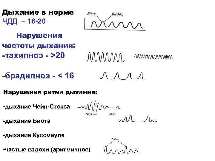 Нарушение частоты