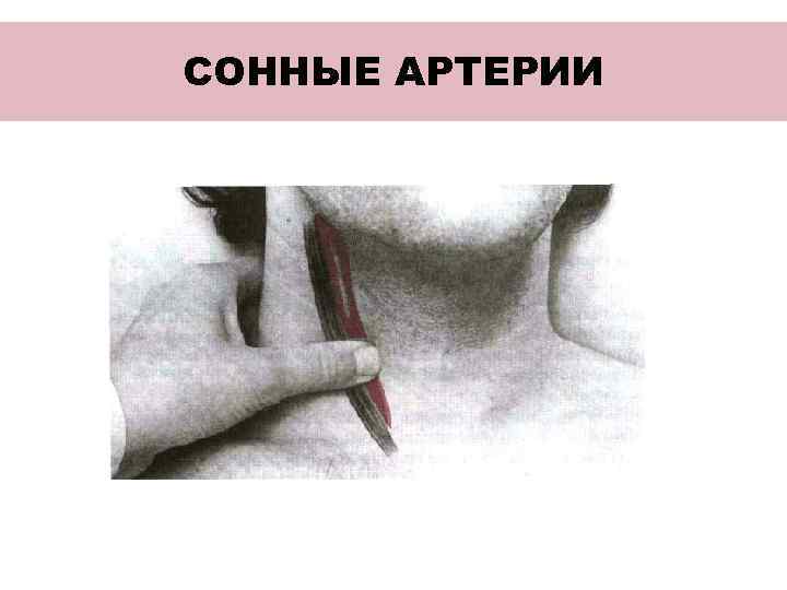 СОННЫЕ АРТЕРИИ 