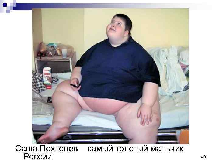 Саша Пехтелев – самый толстый мальчик России 49 