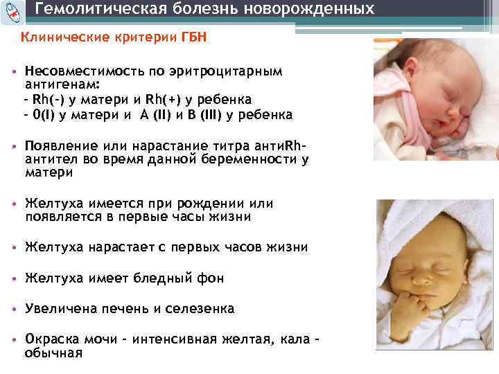 Гемолитическая болезнь новорожденных Клинические критерии ГБН • Несовместимость по эритроцитарным антигенам: - Rh(-) у