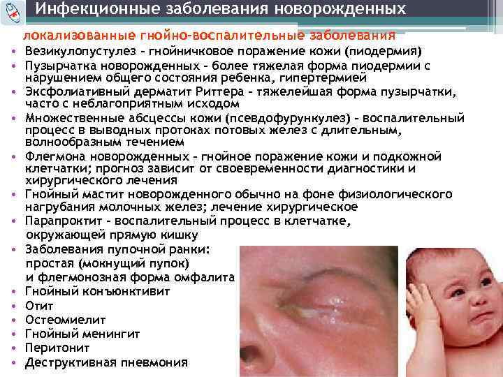 Инфекционные заболевания новорожденных локализованные гнойно-воспалительные заболевания • Везикулопустулез – гнойничковое поражение кожи (пиодермия) •