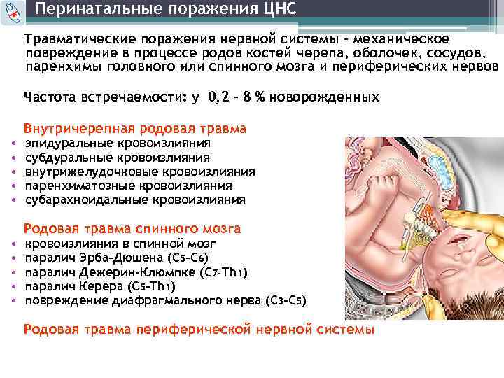 Перинатальные поражения ЦНС Травматические поражения нервной системы – механическое повреждение в процессе родов костей