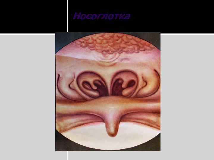 Носоглотка 