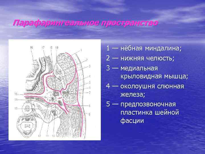 Парафарингеальное пространство 1 — нёбная миндалина; 2 — нижняя челюсть; 3 — медиальная крыловидная