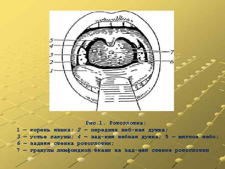 Небные дужки рисунок