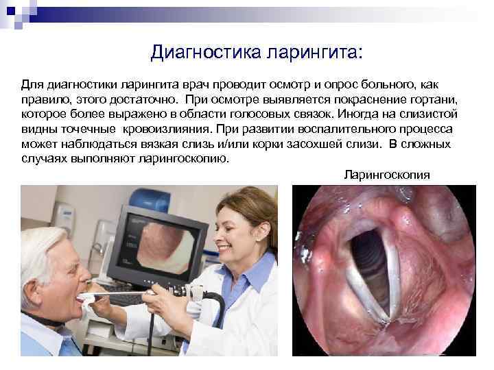 Диагностика ларингита: Для диагностики ларингита врач проводит осмотр и опрос больного, как правило, этого