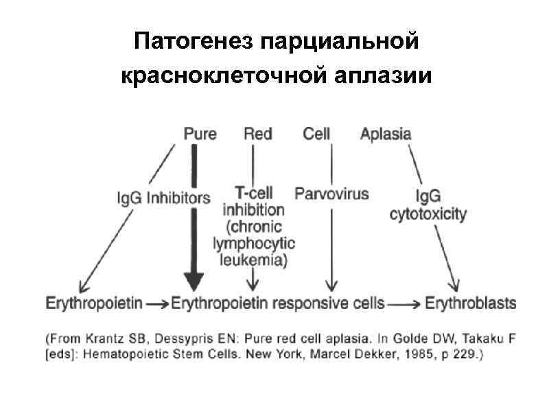 Патогенез парциальной красноклеточной аплазии 