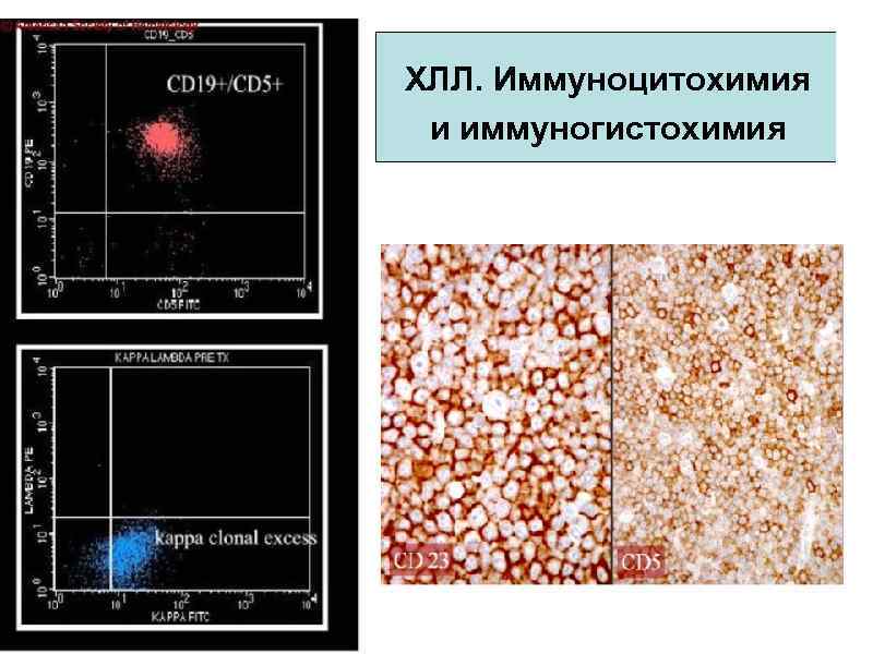 ХЛЛ. Иммуноцитохимия и иммуногистохимия 