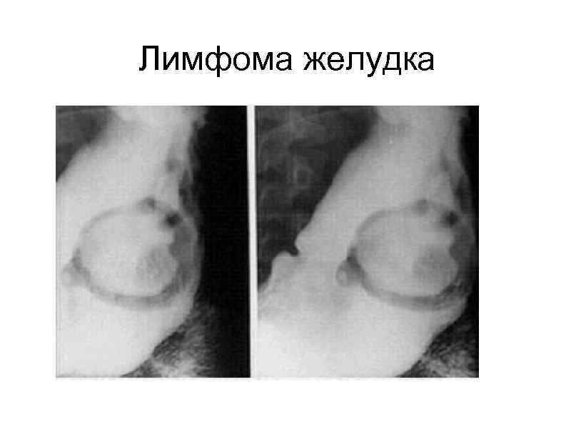 Эндоскопическая картина гпод