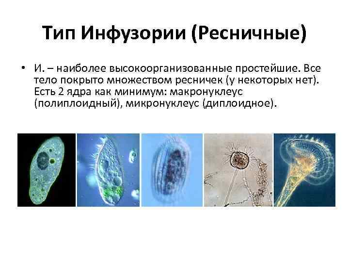 Тип Инфузории (Ресничные) • И. – наиболее высокоорганизованные простейшие. Все тело покрыто множеством ресничек