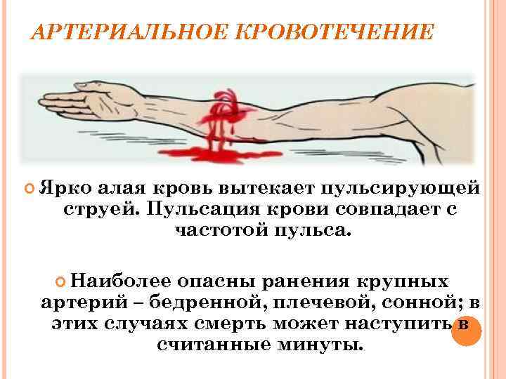 АРТЕРИАЛЬНОЕ КРОВОТЕЧЕНИЕ Ярко алая кровь вытекает пульсирующей струей. Пульсация крови совпадает с частотой пульса.