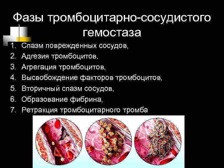 Фазы тромбоцитарно-сосудистого гемостаза 1. 2. 3. 4. 5. 6. 7. Спазм поврежденных сосудов, Адгезия