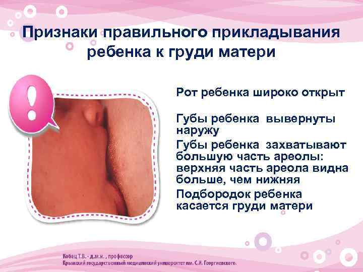 Признаки правильного прикладывания ребенка к груди матери • Рот ребенка широко открыт • Губы