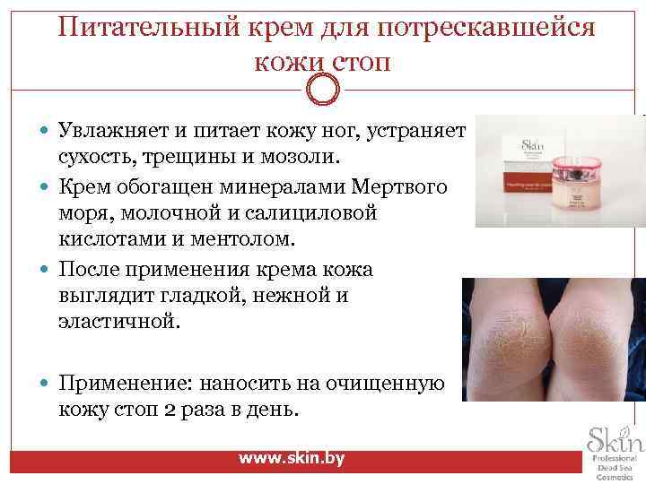  Питательный крем для потрескавшейся кожи стоп Увлажняет и питает кожу ног, устраняет сухость,