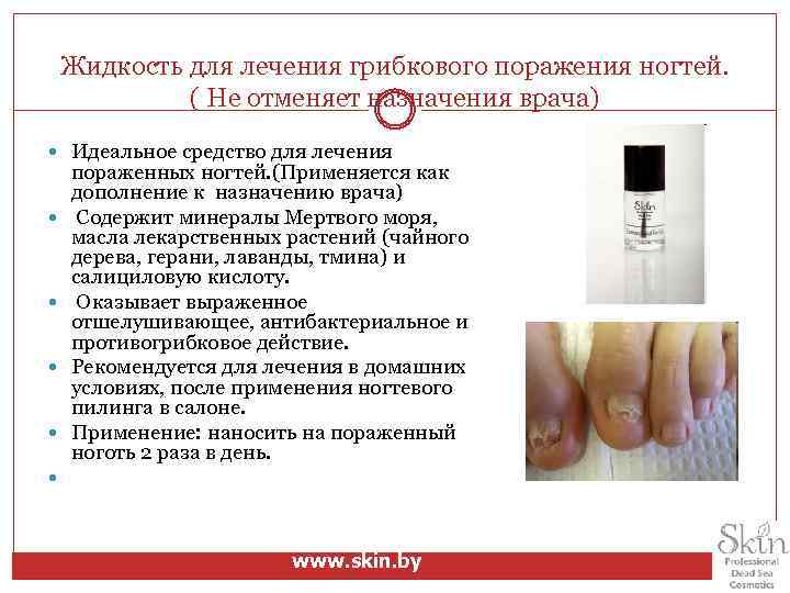 Жидкость для лечения грибкового поражения ногтей. ( Не отменяет назначения врача) Идеальное средство для