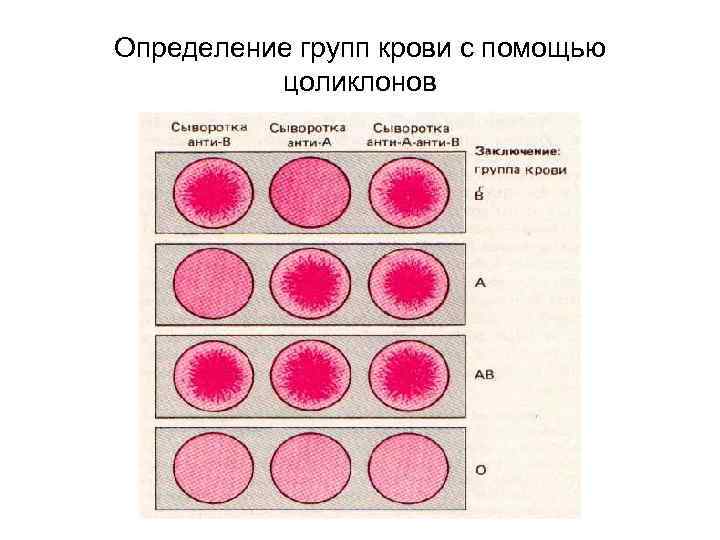 Определение групп крови с помощью цоликлонов 