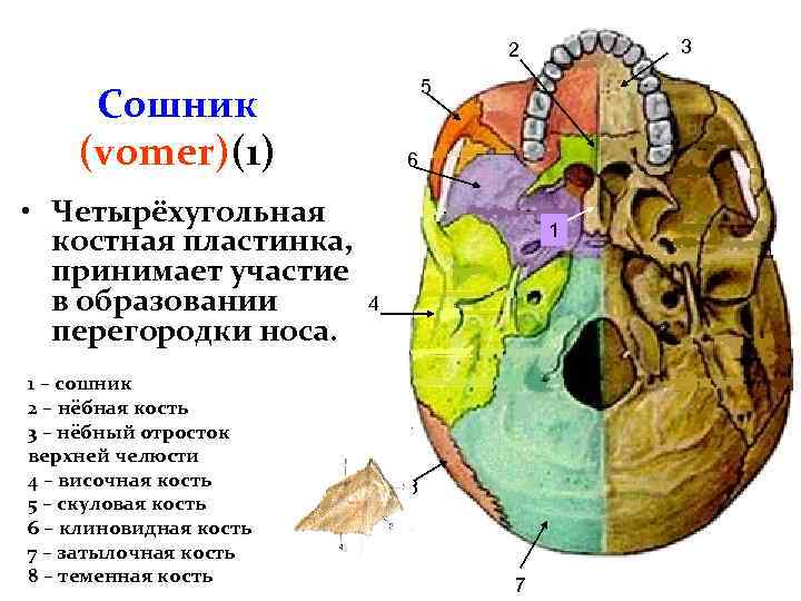 Сошник кость. Строение черепа сошник. Сошник кость анатомия. Сошник кость черепа. Кости черепа сошник.
