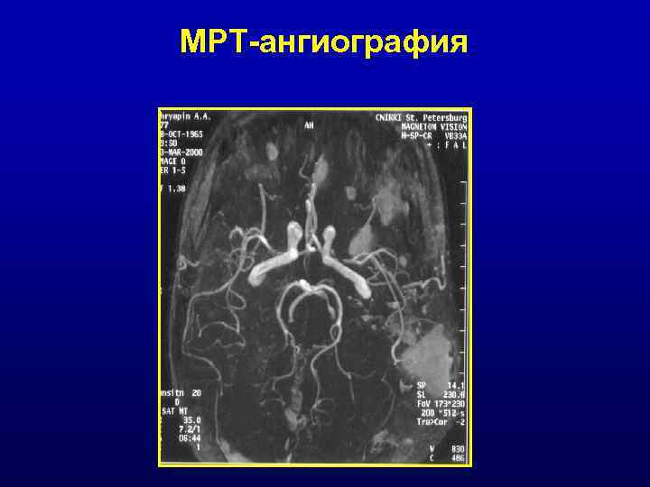 МРТ-ангиография 