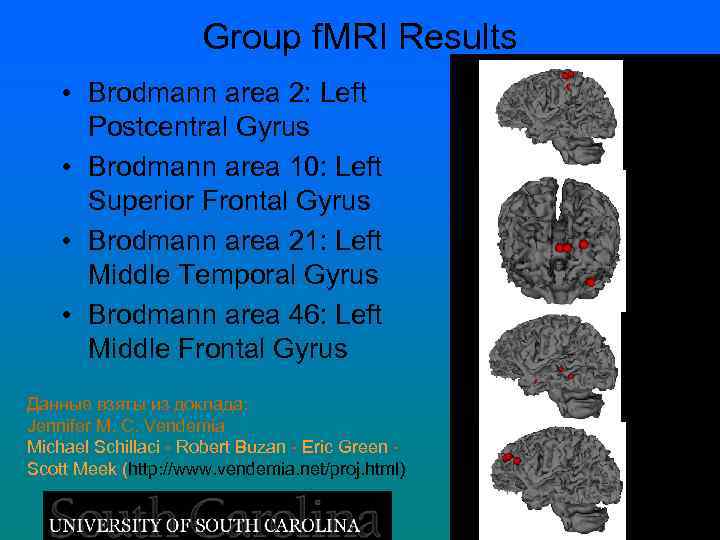 Group f. MRI Results • Brodmann area 2: Left Postcentral Gyrus • Brodmann area