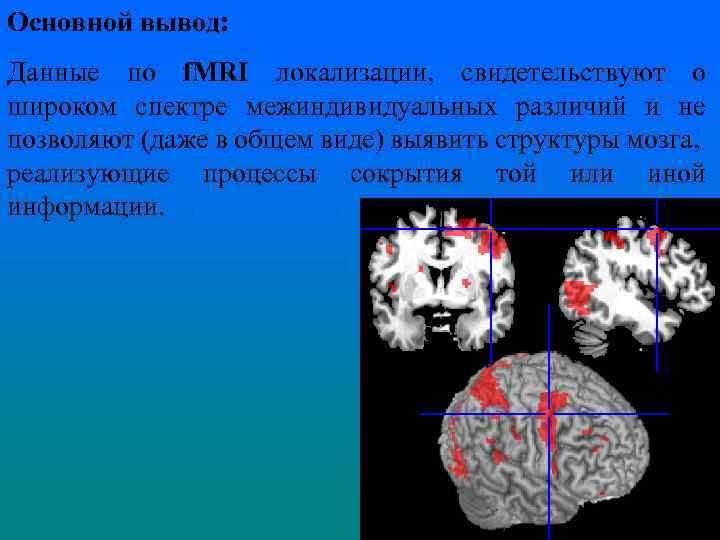 Основной вывод: Данные по f. MRI локализации, свидетельствуют о широком спектре межиндивидуальных различий и