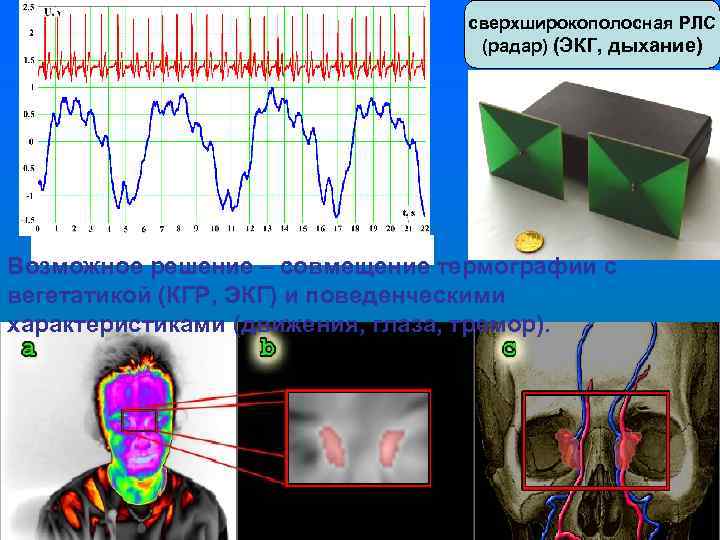 сверхширокополосная РЛС (радар) (ЭКГ, дыхание) Возможное решение – совмещение термографии с вегетатикой (КГР, ЭКГ)
