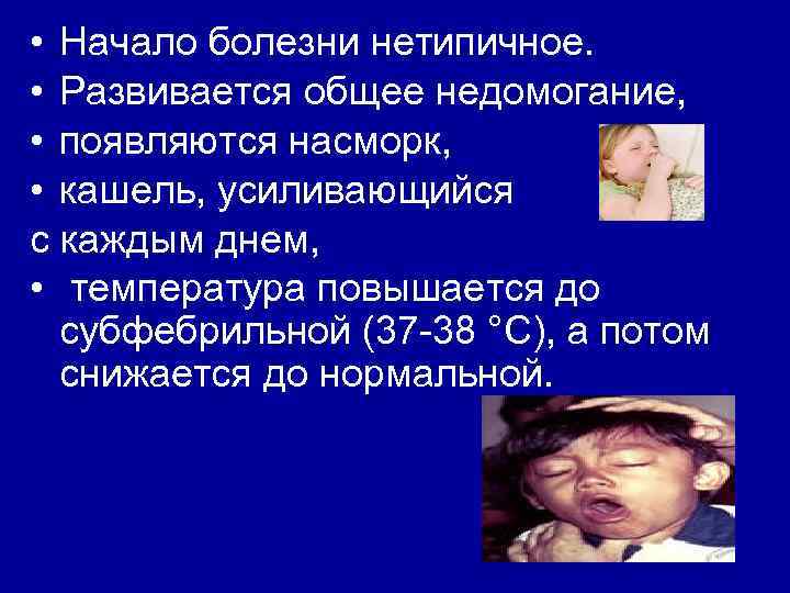  • Начало болезни нетипичное. • Развивается общее недомогание, • появляются насморк, • кашель,