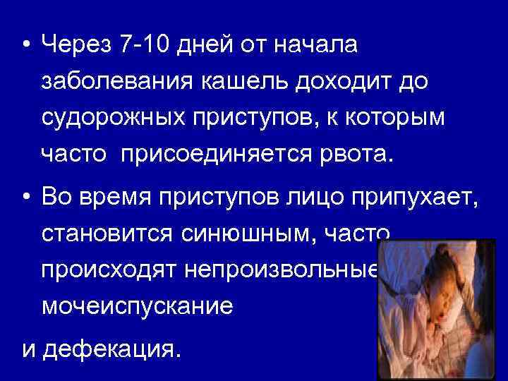  • Через 7 -10 дней от начала заболевания кашель доходит до судорожных приступов,