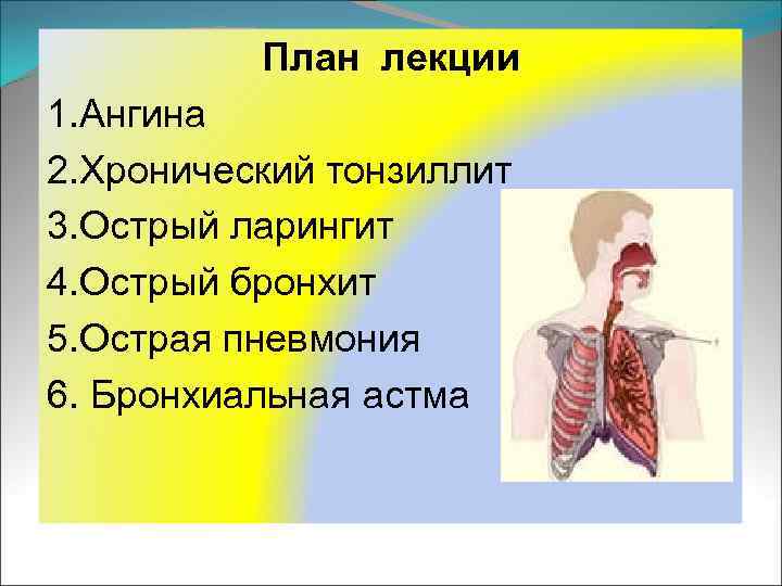 План лекции 1. Ангина 2. Хронический тонзиллит 3. Острый ларингит 4. Острый бронхит 5.