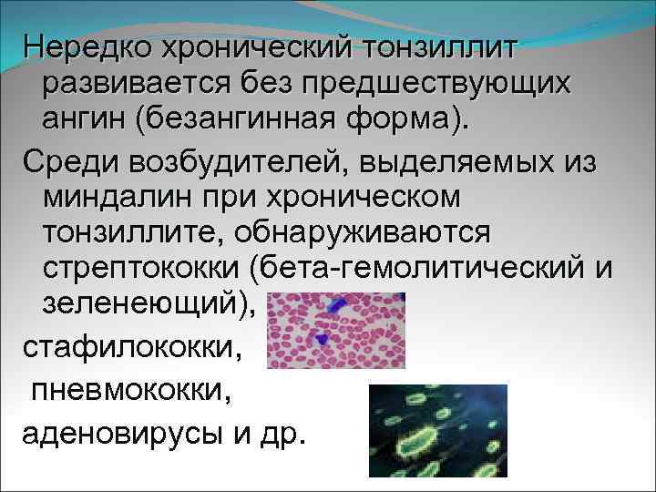 Нередко хронический тонзиллит развивается без предшествующих ангин (безангинная форма). Среди возбудителей, выделяемых из миндалин