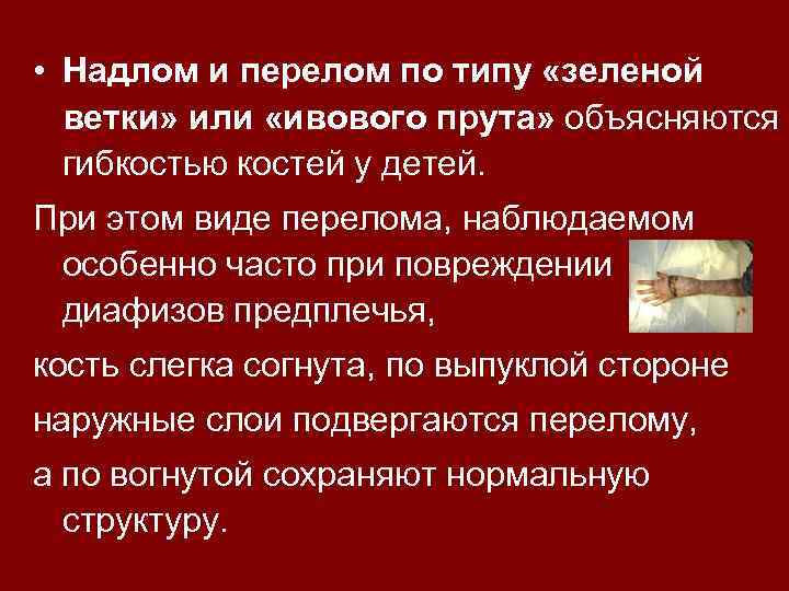  • Надлом и перелом по типу «зеленой ветки» или «ивового прута» объясняются гибкостью