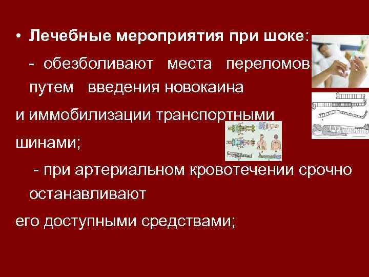  • Лечебные мероприятия при шоке: шоке - обезболивают места переломов путем введения новокаина