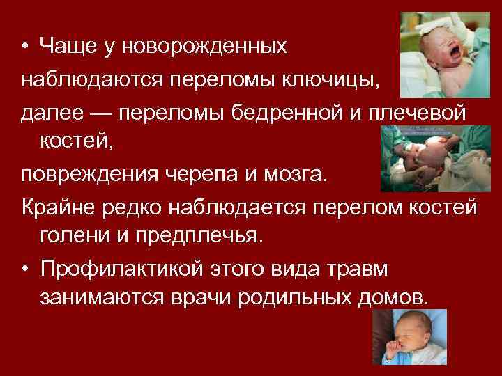  • Чаще у новорожденных наблюдаются переломы ключицы, далее — переломы бедренной и плечевой