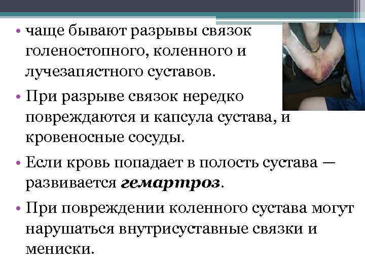  • чаще бывают разрывы связок голеностопного, коленного и лучезапястного суставов. • При разрыве