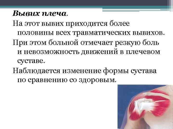 Вывих плеча. На этот вывих приходится более половины всех травматических вывихов. При этом больной