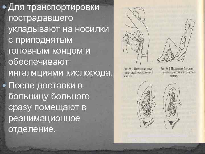  Для транспортировки пострадавшего укладывают на носилки с приподнятым головным концом и обеспечивают ингаляциями