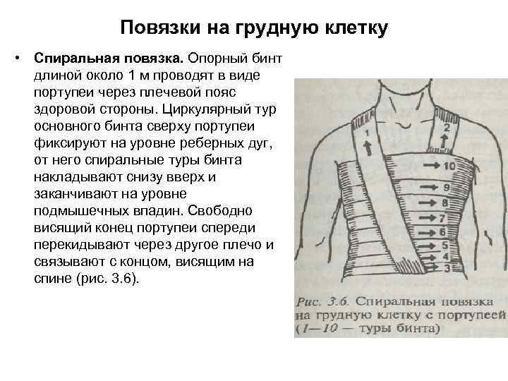 Спиральная повязка на грудную клетку. Портфолио 2 часть