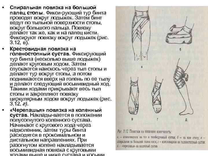  • • • Спиральная повязка на большой палец стопы. Фикси рующий тур бинта