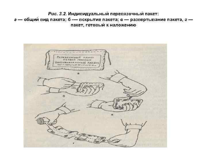 Рис. 3. 2. Индивидуальный перевязочный пакет: а — общий вид пакета; 6 -— вскрытие