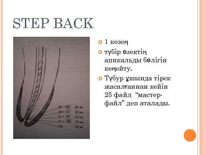 STEP BACK 1 кезең түбір өзектің апикальды бөлігін кеңейту. Түбур ұшында тірек жасалғаннан кейін