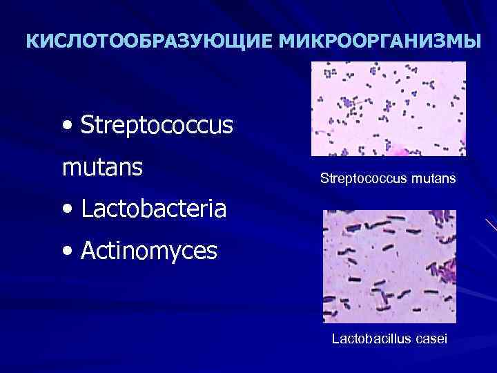 КИСЛОТООБРАЗУЮЩИЕ МИКРООРГАНИЗМЫ • Streptococcus mutans • Lactobacteria • Actinomyces Lactobacillus casei 