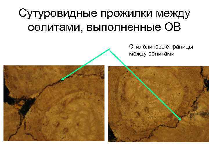 Сутуровидные прожилки между оолитами, выполненные ОВ Стилолитовые границы между оолитами 