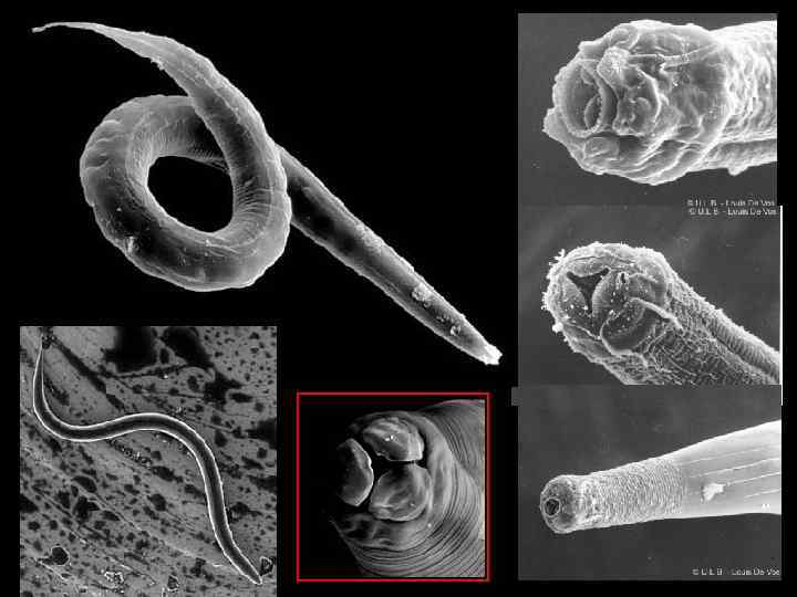 Нематода под микроскопом фото