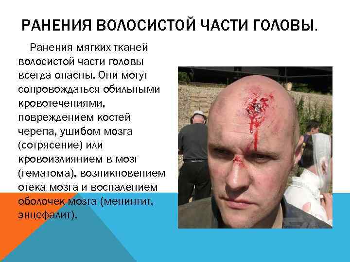 РАНЕНИЯ ВОЛОСИСТОЙ ЧАСТИ ГОЛОВЫ. Ранения мягких тканей волосистой части головы всегда опасны. Они могут