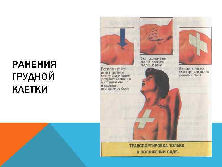 РАНЕНИЯ ГРУДНОЙ КЛЕТКИ 