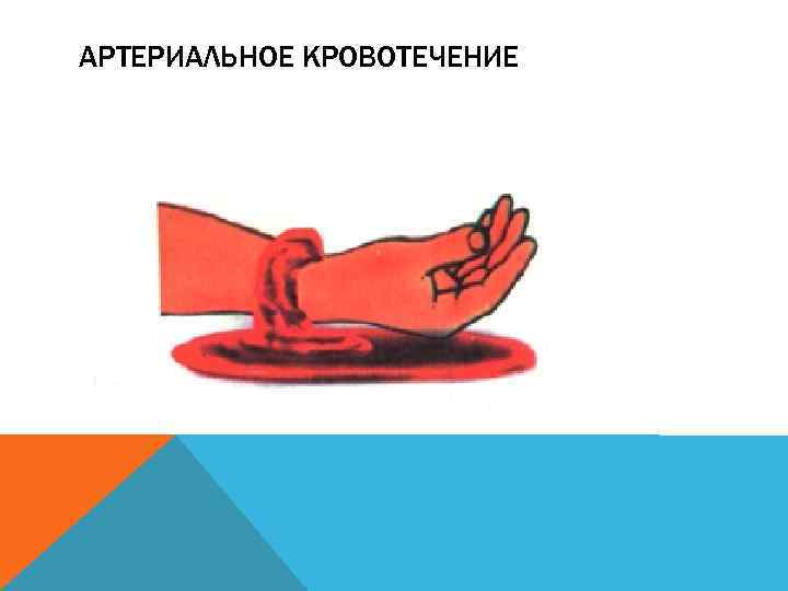 АРТЕРИАЛЬНОЕ КРОВОТЕЧЕНИЕ 