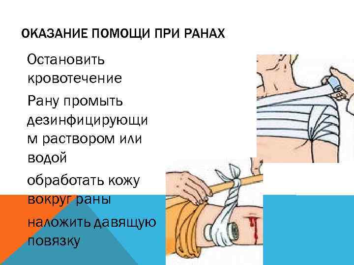 ОКАЗАНИЕ ПОМОЩИ ПРИ РАНАХ Остановить кровотечение Рану промыть дезинфицирующи м раствором или водой обработать